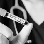 Dua Dokter di Simeulue Positif Covid-19