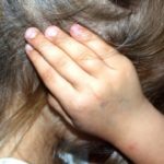 Seorang Ibu di Aceh Timur Tega Siram Anak dengan Air Panas