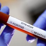 Plt Kadiskes dan Tujuh Warga Aceh Selatan Positif Covid-19