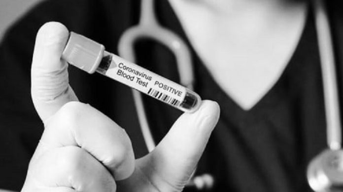 Ilustrasi-positif-corona.-Foto-istimewa642ca2012948b12cb3c9e3c13d8be527.md_