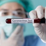 Setelah Wakil Bupati, Kini Bupati Simeulue Erli Hasim Positif Covid-19