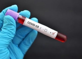 38 Pasien Covid-19 Aceh Sembuh, Paling Banyak Warga Lhokseumawe