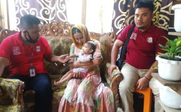 Haji Uma dan YARA Bantu Aqila, Balita Penderita Gizi Buruk Asal Aceh Utara