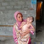 Alami Kebutaan dan Lumpuh, Bocah Sembilan Tahun di Abdya Butuh Uluran Tangan